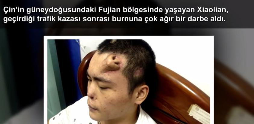 Dünya'da 5 Gereksiz Ameliyat!
