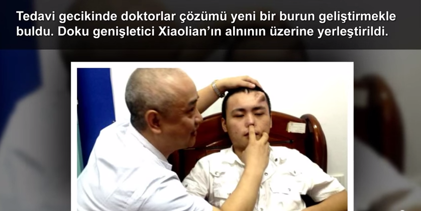 Dünya'da 5 Gereksiz Ameliyat!