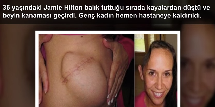 Dünya'da 5 Gereksiz Ameliyat!