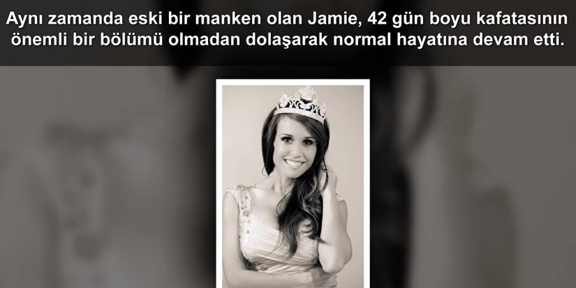 Dünya'da 5 Gereksiz Ameliyat!