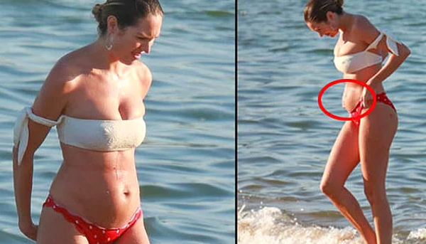 Victoria's Secret Modeli Candice Swanepoel, Doğum Sonrası Göbeğine Gelen Eleştirilere Kapak Gibi Cevap Verdi!