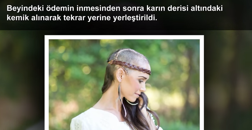 Dünya'da 5 Gereksiz Ameliyat!