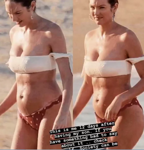 Victoria's Secret Modeli Candice Swanepoel, Doğum Sonrası Göbeğine Gelen Eleştirilere Kapak Gibi Cevap Verdi!