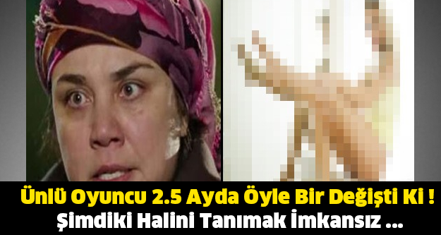 Ünlü Oyuncu 2.5 Ayda Öyle Bir Değişti Ki ! Şimdiki Halini Tanımak İmkansız ...