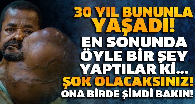 TAM 30 YIL BUNUNLA YAŞADI! EN SONUNDA ÖYLE BİR ŞEY YAPTILAR Kİ... ONA BİRDE ŞİMDİ BAKIN! ŞOK OLACAKSINIZ!