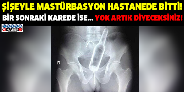 ŞİŞEYLE MASTÜRBASYON HASTANEDE BİTTİ! BİR SONRAKİ KAREDE İSE... YOK ARTIK DİYECEKSİNİZ!