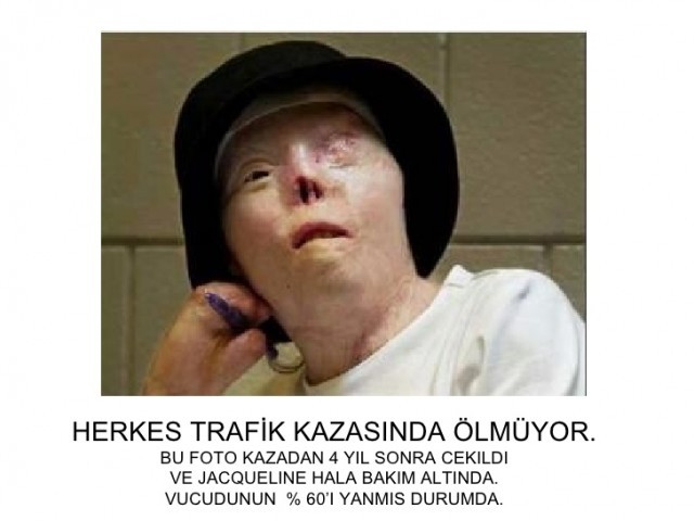Alkol tüketmemek için 14 sebep!