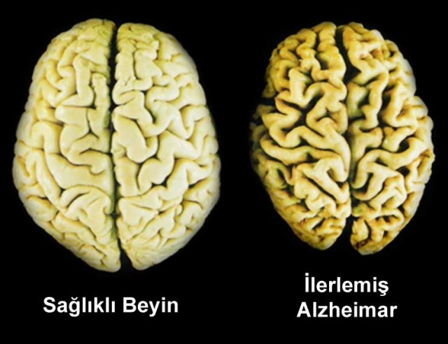 Beyniniz Nasıl Çalışıyor Bu Test 3 Aşamadan Oluşmaktadır..