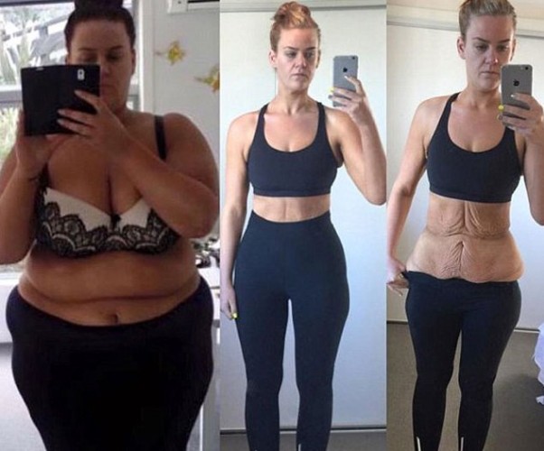 11 ayda tam 86 kilo verdi değişimini görenler gözlerine inanamadı!