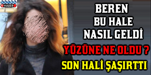 BEREN SAAT BU HALE NASIL GELDİ !