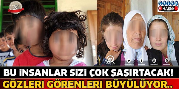 Bu İnsanların Gözleri Herkesi Büyülüyor ! Görünce Şoke Olacaksınız...