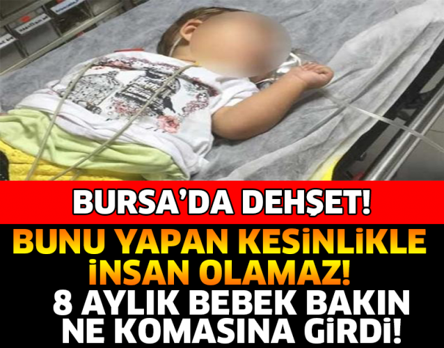 BURSA'DA DEHŞET! BUNU YAPAN KESİNLİKLE İNSAN OLAMAZ! 8 AYLIK BEBEK BAKIN NE KOMASINA GİRDİ...