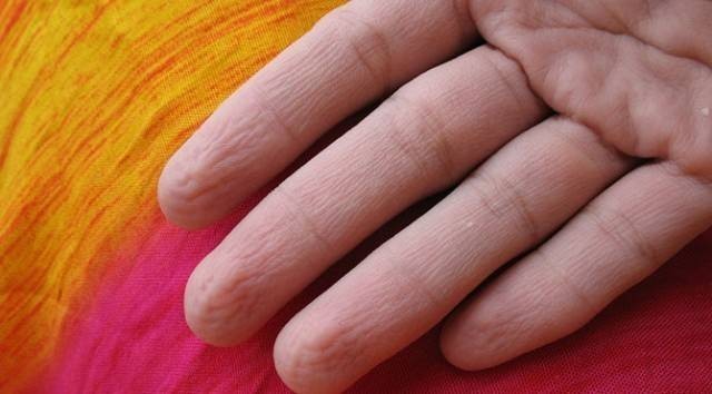 EĞER ELLERİNİZ BÖYLE OLUYORSA.. ASLINDA BU BİR YETENEK! ELiNİZİN BÖYLE OLMASININ NEDENİ..