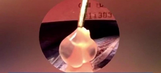 BAŞ AĞRISI DİYE GİTTİ FİLMİNDEN ÇIKAN SONUÇ DOKTORU BAYILTTI..!