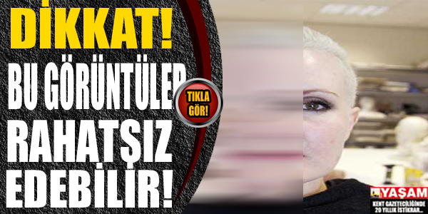 DİKKAT!!! Bu görüntülerden rahatsız olabilirsiniz...