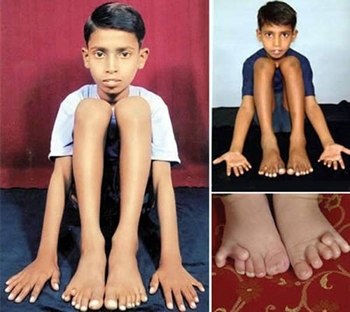 En acayip organ rekorları,çıldırtıyor!!!