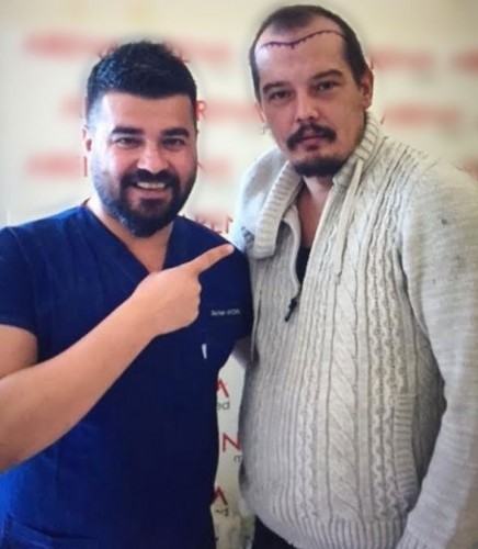 Ve Arda Kural'dan beklenen adım! Bakın nasıl değişti!