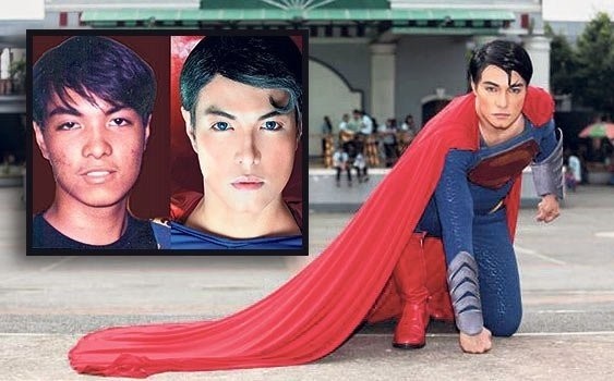 Superman'e Benzemek İçin 23 Kez Ameliyat Oldu! Son Hali Şok Etti..