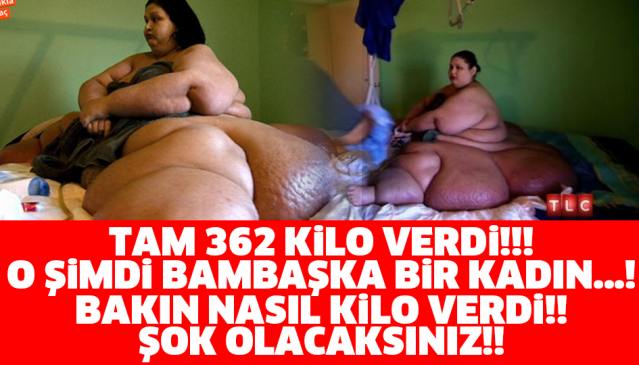 TAM 362 KİLO VERDİ!!! O ŞİMDİ BAMBAŞKA BİR KADIN…! BAKIN NASIL KİLO VERDİ!! ŞOK OLACAKSINIZ!!