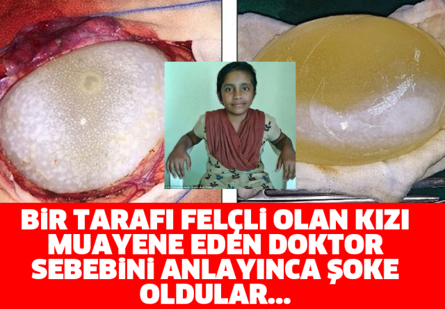 BİR TARAFI FELÇLİ OLAN KIZI MUAYENE EDEN DOKTOR SEBEBİNİ ANLAYINCA ŞOKE OLDULAR...