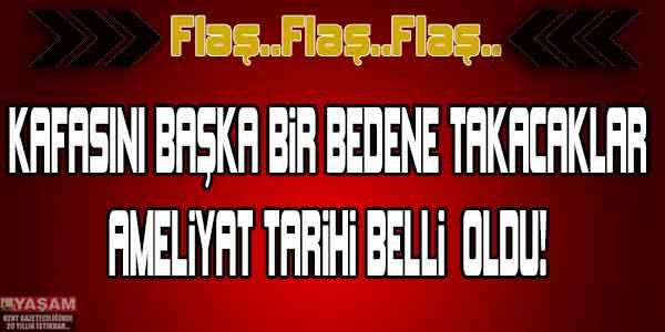 KAFASINI BAŞKA BİR BEDENE TAKACAKLAR..!