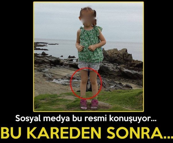 Korkunç Olay ! Bu Resime Dikkatlice Bakın..
