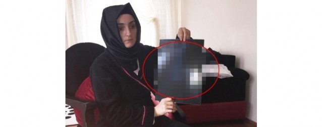 DOKTOR İNANMADI PSİKOLOJİK DEDİ AMA...  KARNINDAN ÇIKANI GÖRÜNCE BAYILDI!