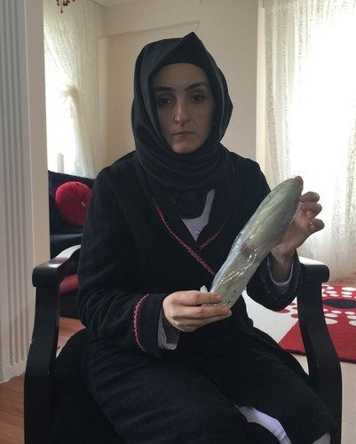 DOKTOR İNANMADI PSİKOLOJİK DEDİ AMA...  KARNINDAN ÇIKANI GÖRÜNCE BAYILDI!