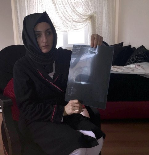 DOKTOR İNANMADI PSİKOLOJİK DEDİ AMA...  KARNINDAN ÇIKANI GÖRÜNCE BAYILDI!