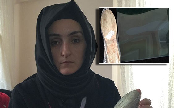 DOKTOR İNANMADI PSİKOLOJİK DEDİ AMA...  KARNINDAN ÇIKANI GÖRÜNCE BAYILDI!