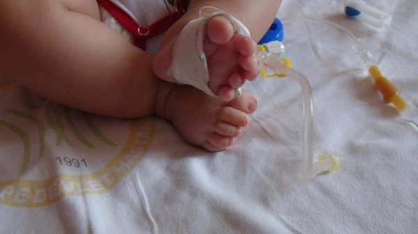 24 parmaklı bebek görenleri hayrete düşürdü!