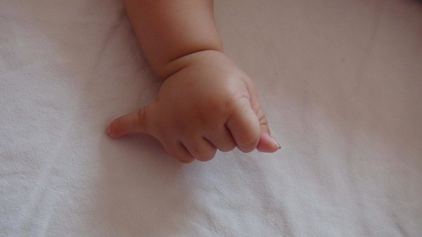 24 parmaklı bebek görenleri hayrete düşürdü!