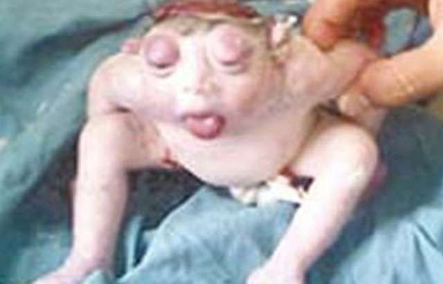 Kurbağa Bebek Görenleri Şok Etti!