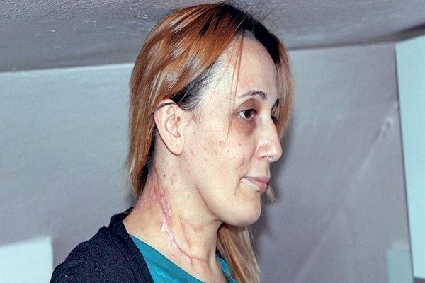 BAYANLAR DİKKAT! LAVABOYA DÖKTÜ BOMBA GİBİ PATLADI!