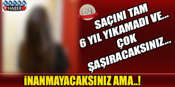 İNANMAYACAKSINIZ AMA TAM 6 YIL SAÇLARINI YIKAMADI...