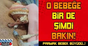 PARMAK BEBEK BÜYÜDÜ O BEBEĞE BİR DE ŞİMDİ BAKIN...