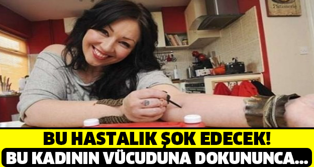 Bu hastalık şoke edecek! Bu kadının vücuduna dokununca bakın ne oluyor?