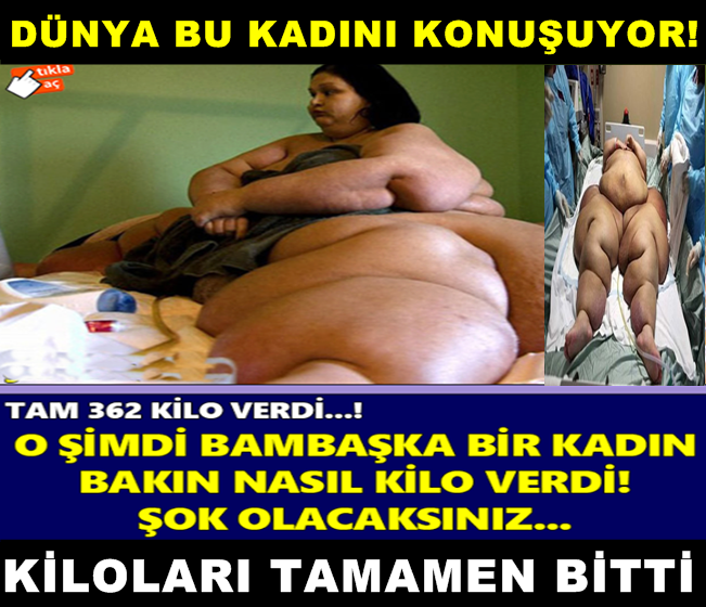 BİR DE ŞİMDİKİ HALİNİ GÖRÜN... O ŞİMDİ BAMBAŞKA BİR KADIN...!