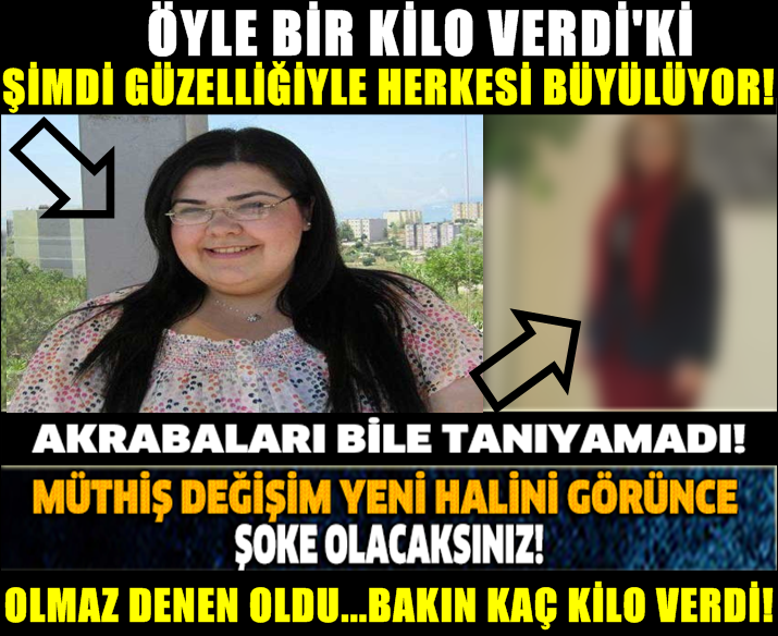 MÜTHİŞ DEĞİŞİM! AĞZINIZ AÇIK KALACAK..!!
