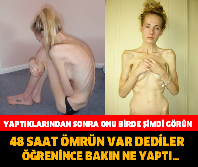 48 SAAT ÖMRÜN VAR DEDİLER BAKIN NE YAPTI… ONU BİRDE ŞİMDİ GÖRÜN!