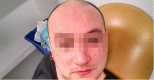 GÖZLERİNE ÖYLE BİR ŞEY YAPTIRDI Kİ ŞOK OLACAKSINIZ!