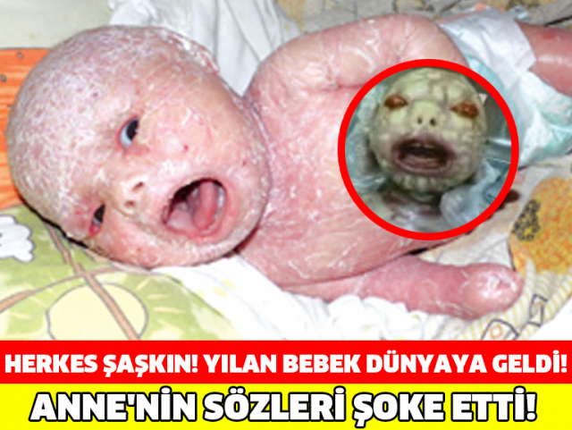 HERKES ŞAŞKIN! YILAN BEBEK DÜNYAYA GELDİ! ANNE'NİN SÖZLERİ ŞOKE ETTİ!