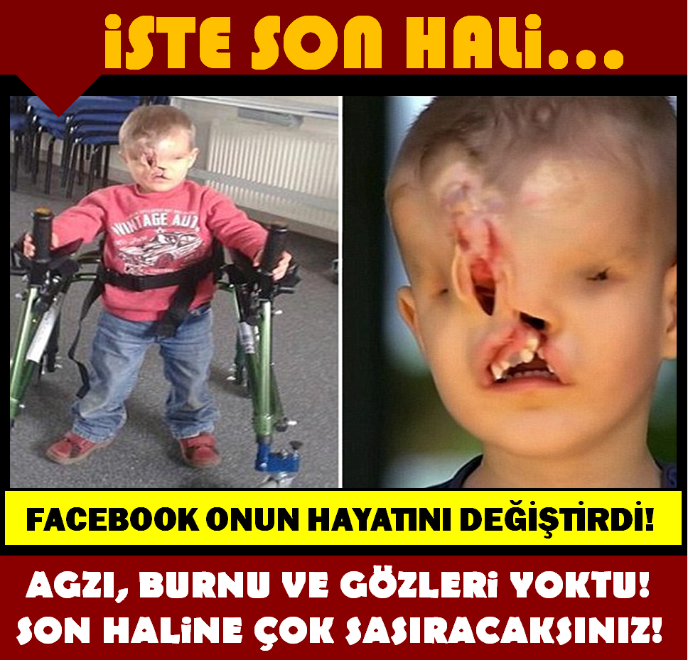 AĞZI BURNU VE GÖZLERİ YOKTU! SON HALİNE ÇOK ŞAŞIRACAKSINIZ!