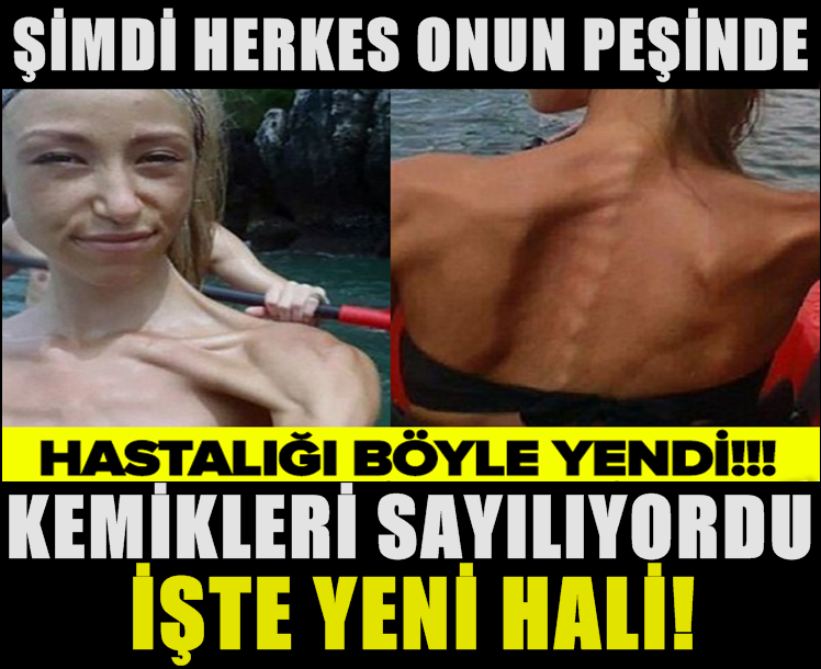 SON HALİNİ GÖRENLER İNANAMIYOR! BAKIN ŞİMDİ NE HALDE...