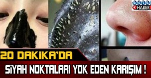 20 dakikada siyah noktaları yok eden karışım !