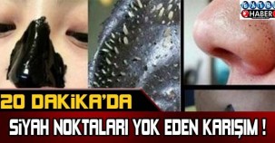 20 dakikada siyah noktaları yok eden karışım !