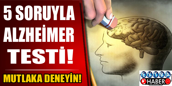 5 Soruyla Alzheimer Testi! Mutlaka Deneyin..