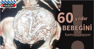 Bebeğini 60 Yıl Boyunca Karnında Taşıdı!!