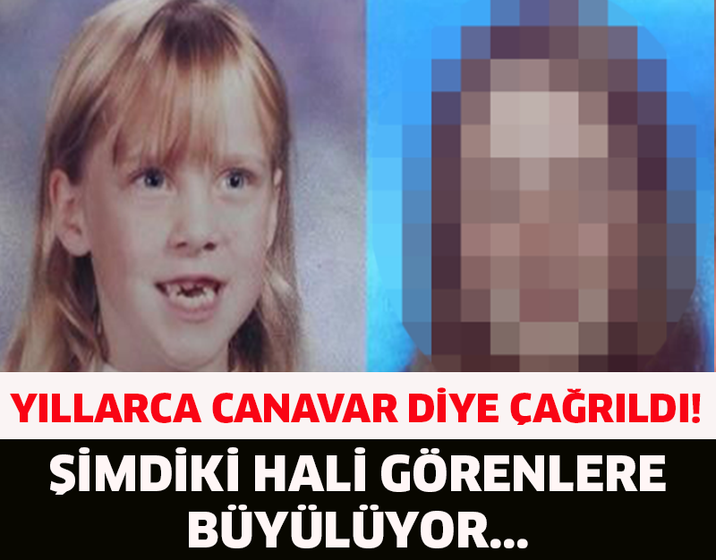 YILLARCA CANAVAR DİYE ÇAĞRILDI! ŞİMDİKİ HALİ GÖRENLERİ BÜYÜLÜYOR..