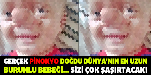 GERÇEK PİNOKYO DOĞDU DÜNY'NIN EN UZUN BURUNLU BEBEĞİ... SİZİ ÇOK ŞAŞIRTACAK!